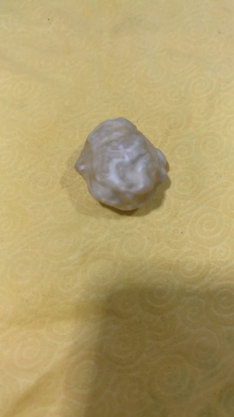 羊结石