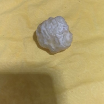 羊结石