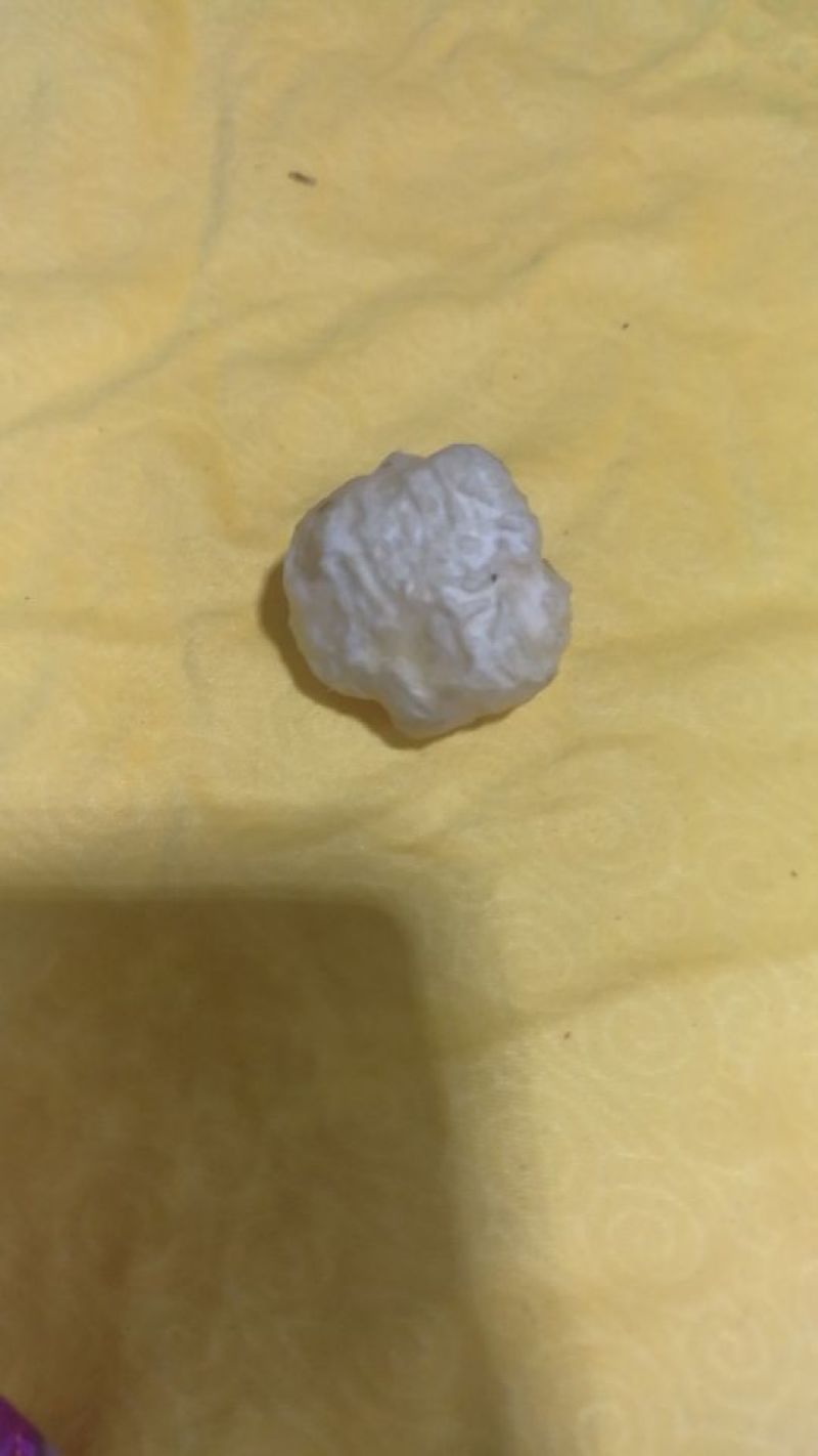 羊结石