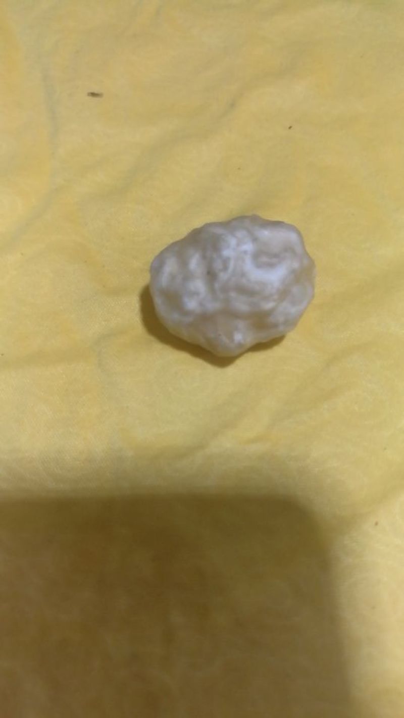 羊结石