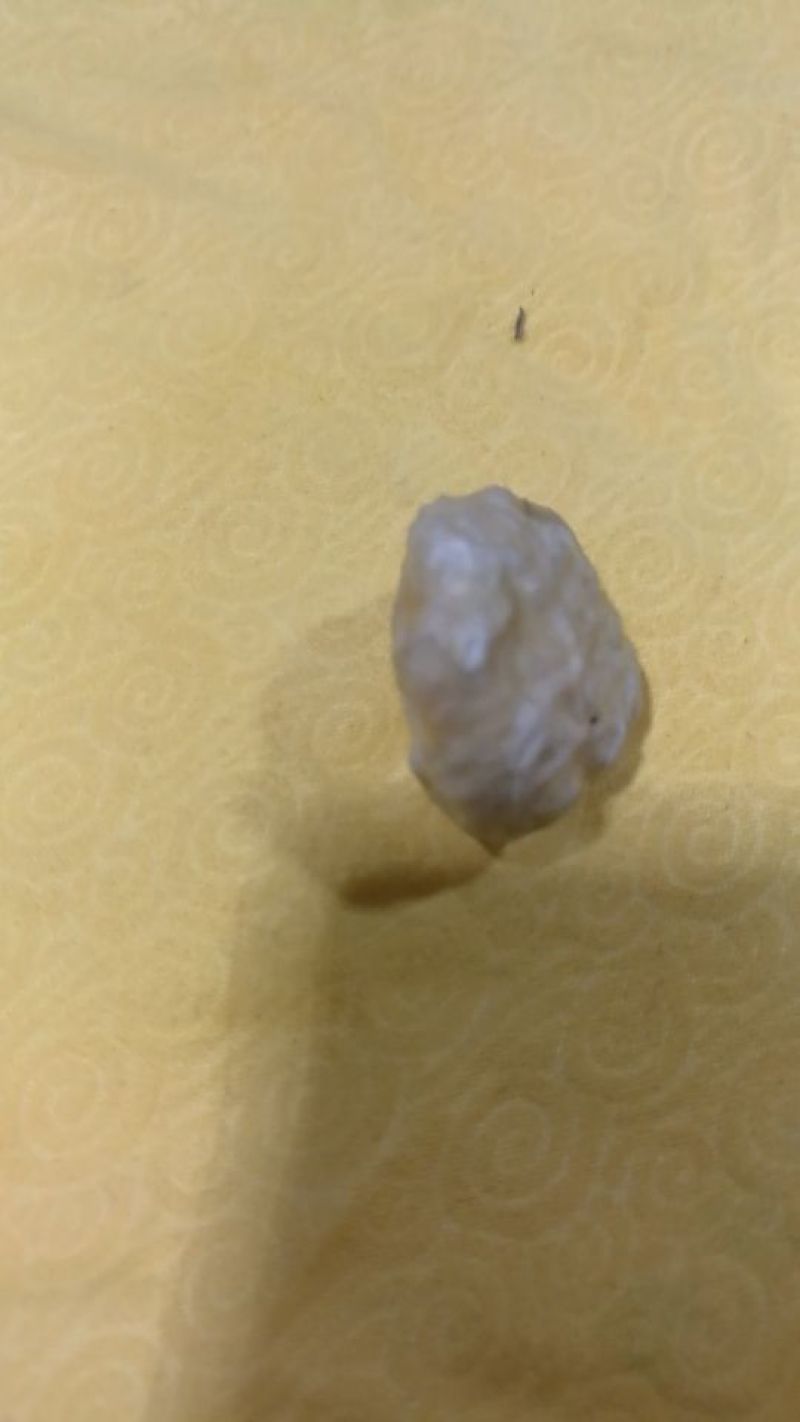 羊结石