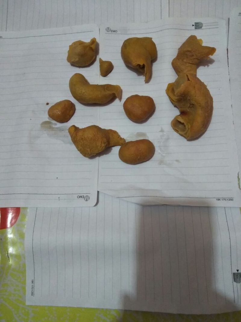 鸡宝是自己家养的老母鸡