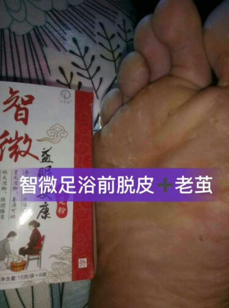 藏红花专治脚气