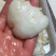 小赤鱼胶