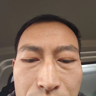 大蒜