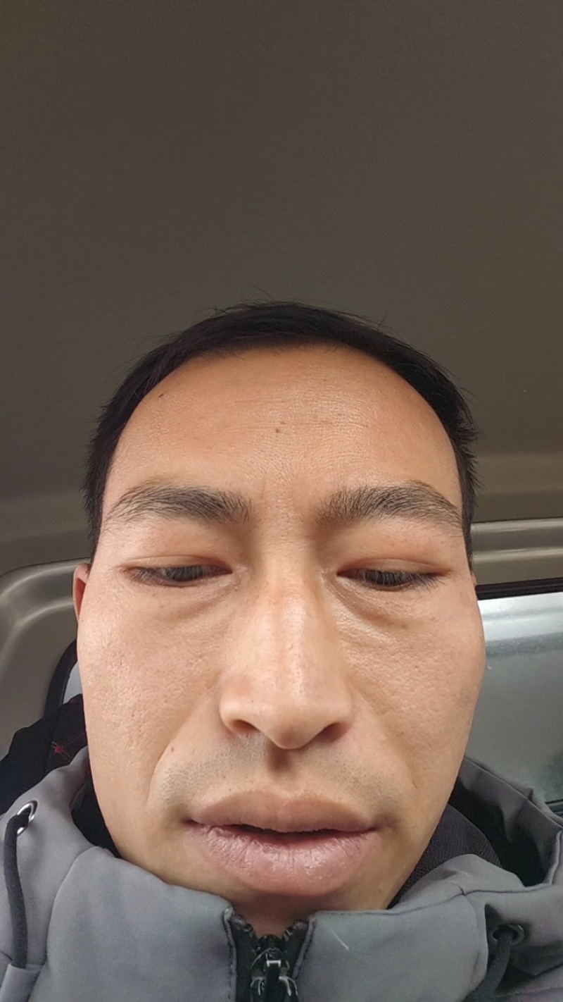 大蒜