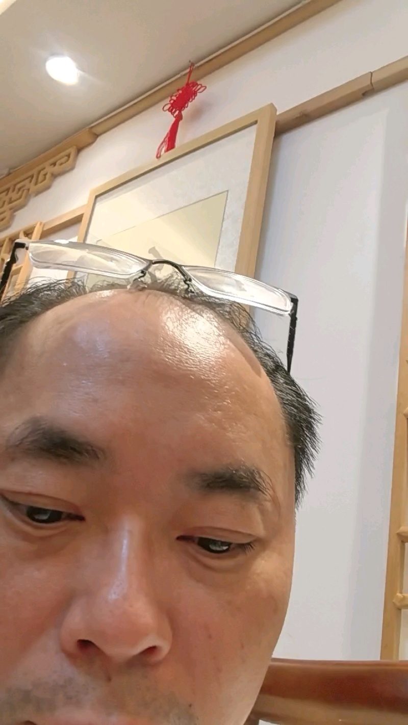 缅甸杜卡碎米