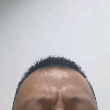 新鲜赤松茸（预售）