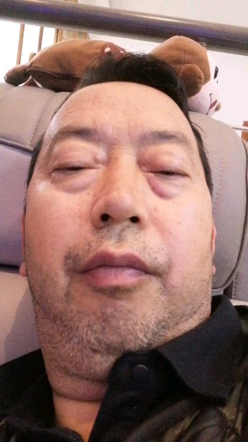 云南昭通小草坝天麻