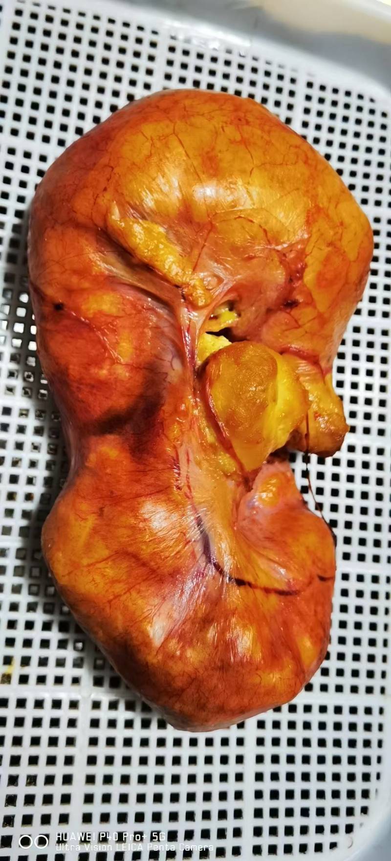 鸡宝精美鸡宝价钱可谈可以视频看货欢迎联系