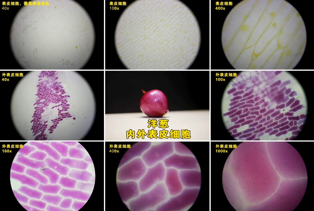 科研示意图:倒置荧光显微镜拍摄的体外细胞实验结果。左侧为未处理对照组(NIS绿色荧光微弱均匀);右侧为添加10μM紫皮洋葱DADS提取物处理48小时组(NIS荧光信号显著增强、呈膜定位聚集,标尺50μm) 实验室场景:显微镜下人甲状腺滤泡细胞(FRTL-5)经紫皮洋葱提取物处理后NIS蛋白荧光染色增强