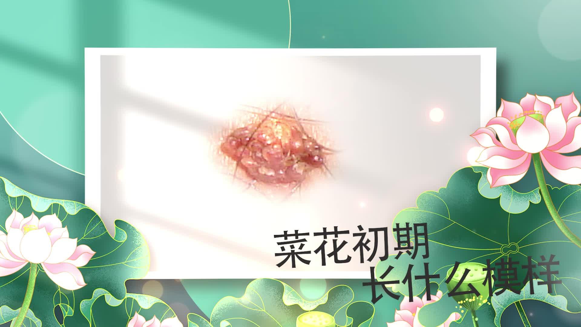 菜花典型生长阶段对比示意图,展示幼苗期、莲座期与花球始期的形态差异,背景为露地绿色田间环境,土壤湿润疏松,无病虫害迹象 菜花不同生长阶段对比图:左侧为幼苗期(3叶1心),中部为莲座期(叶片茂盛、茎秆粗壮),右侧为花球膨大初期(白色花球初现,紧实饱满)