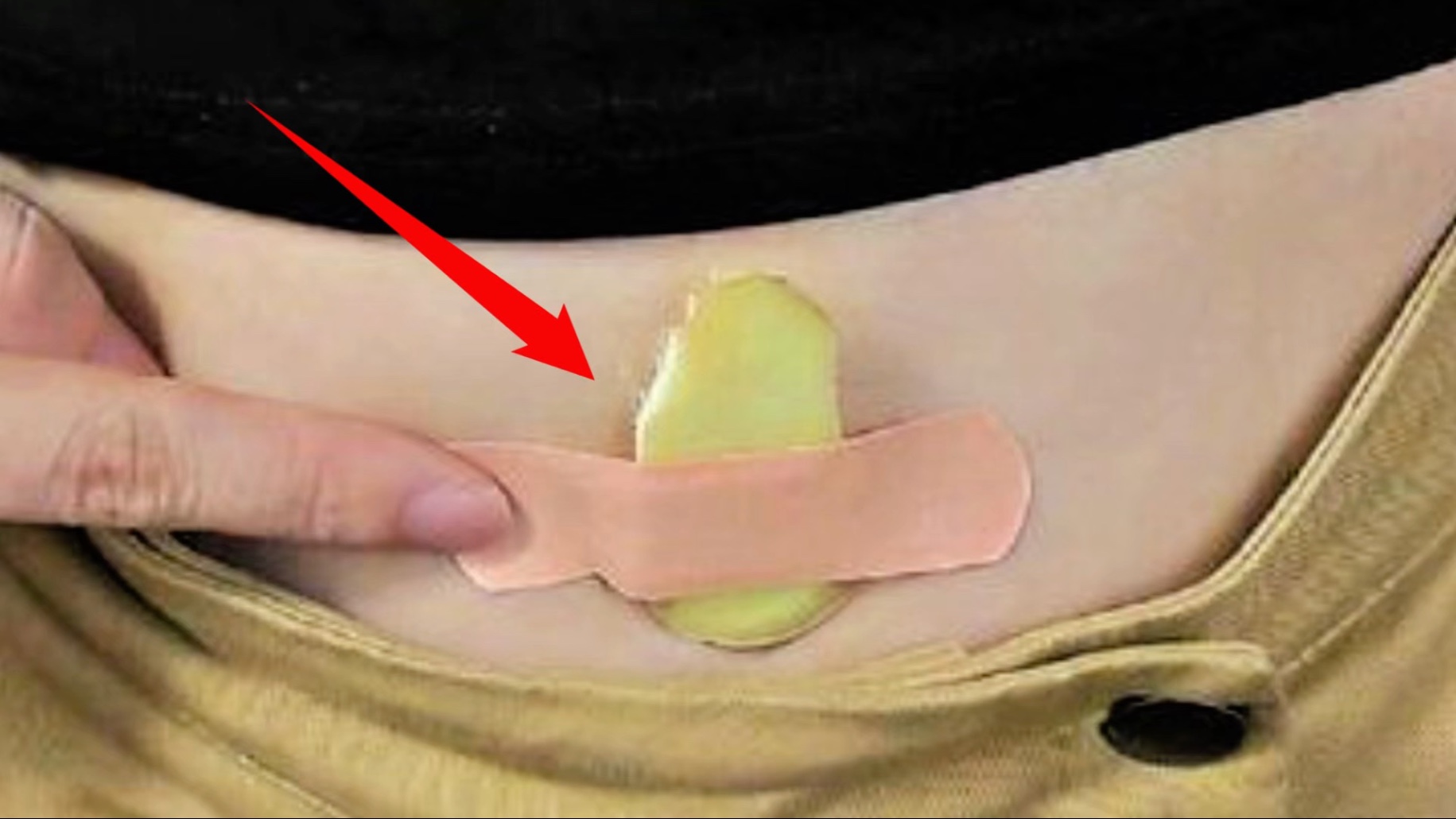 对比图：正常足部皮肤 vs 鸡眼患处 vs 使用独头蒜后可能出现的皮肤反应