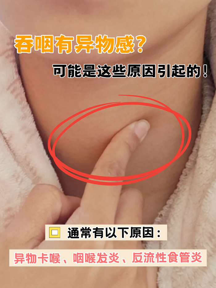 咽喉解剖示意图