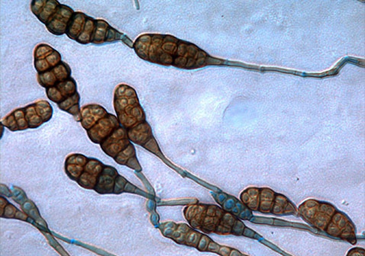 光学显微镜视野中显示大量椭圆形、浅褐色的Cladosporium cacti分生孢子,呈链状排列,背景为培养基上的霉层结构,用于展示病原菌微观特征 显微镜下火龙果疮痂病菌孢子形态