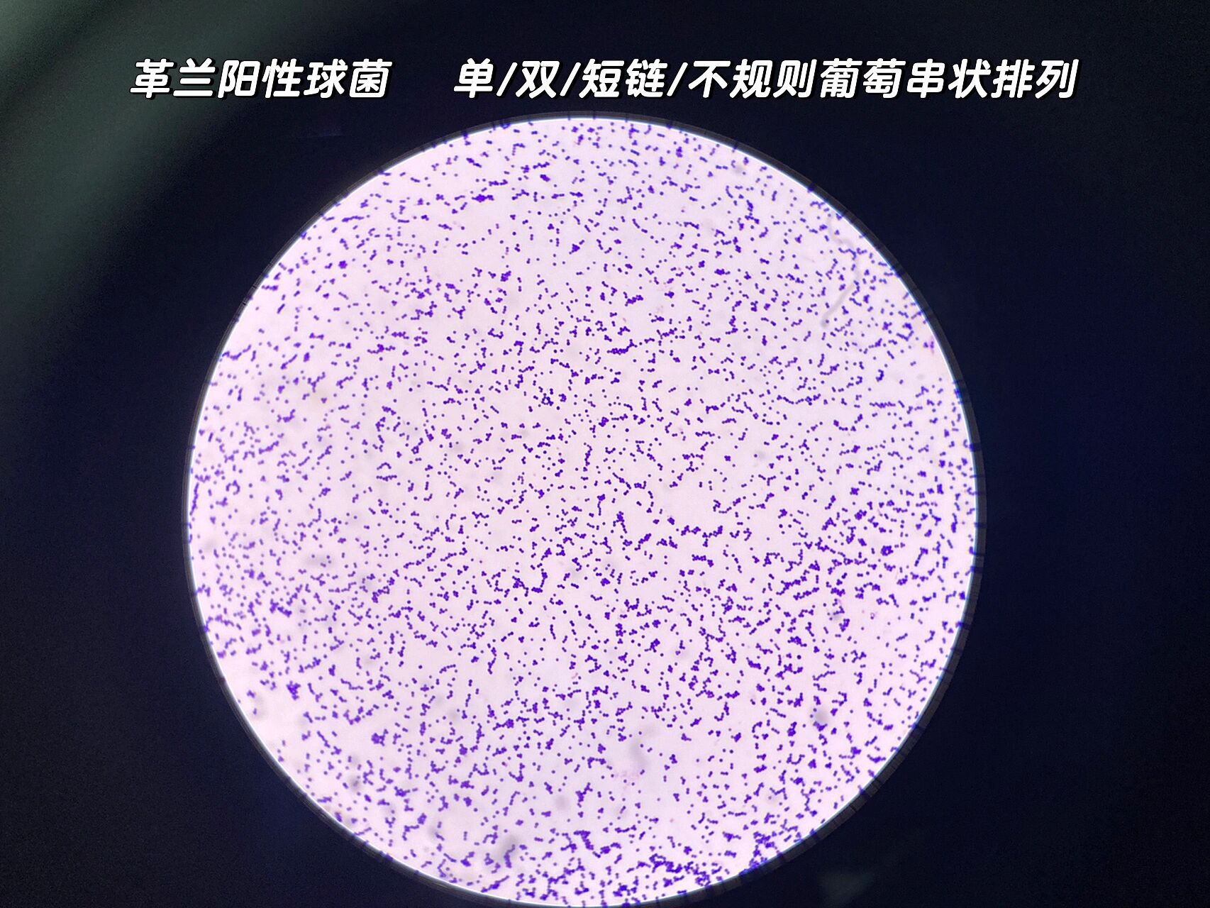 光学显微镜下观察到的副溶血弧菌,呈短杆状、两端钝圆,革兰氏染色阴性,紫色背景下清晰可见单个或成对排列的细菌结构,背景为实验室载玻片环境 显微镜下副溶血弧菌形态图
