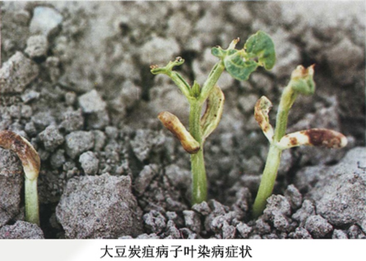 无筋豆炭疽病高清显微级症状图:清晰展示豆荚病斑凹陷结构、轮纹特征及粉红色分生孢子堆 无筋豆炭疽病典型症状特写:豆荚表面多枚椭圆形深褐色凹陷病斑,边缘紫红色隆起,中心灰白色,部分病斑表面覆盖粉红色胶质霉层;叶片病斑呈圆形,中央灰白、外围紫红环带
