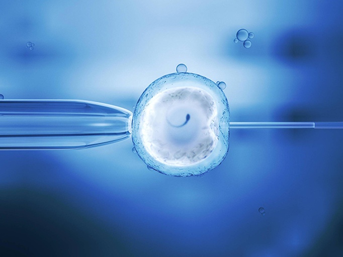 人工授精操作流程图