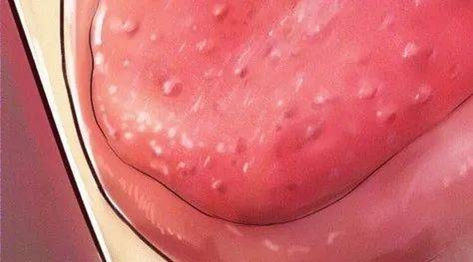 口腔特写示意图