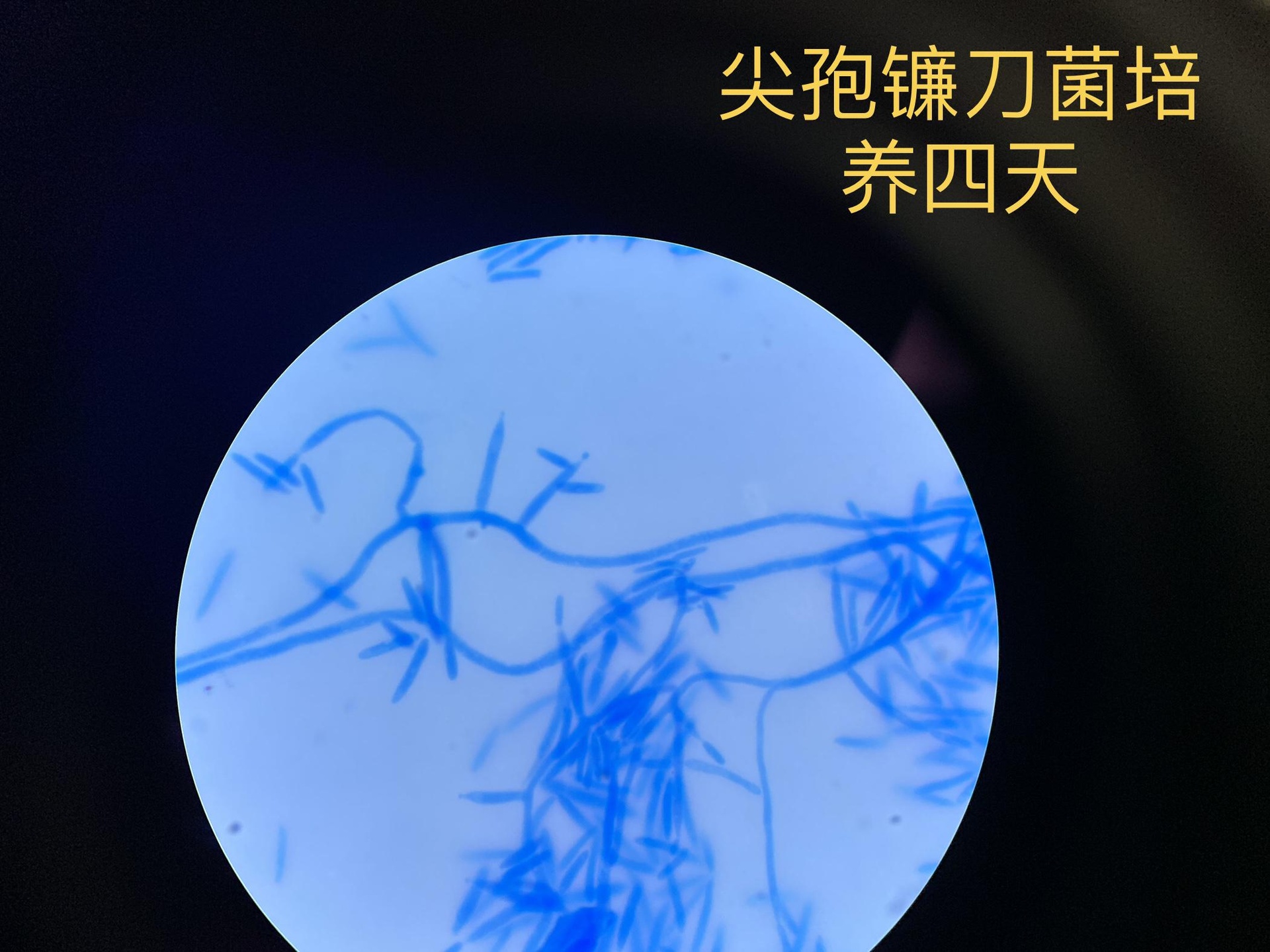 显微镜下显示禾谷镰刀菌的分生孢子,呈镰刀状,多细胞,浅粉色至淡紫色;菌丝白色絮状,生长于PDA培养基表面;图像背景为实验室环境,配有标尺,放大倍数约400x 小麦赤霉病病原菌显微结构