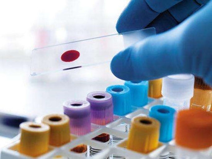 一位身穿白色实验服的研究人员在现代化实验室中使用分光光度计分析血橙提取液,屏幕上显示多酚浓度曲线,桌面上摆放着试管架和血橙样本,体现科学研究的专业性 实验室研究人员正在检测血橙提取物的多酚含量