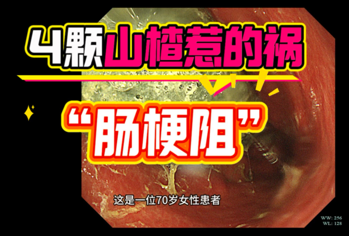 肠道菌群代谢示意图：箭头清晰标注‘山楂果胶→结肠双歧杆菌/粪杆菌→发酵→乙酸+丙酸+丁酸+H₂↑+CO₂↑’，背景为显微镜下双歧杆菌杆状形态与山楂果胶分子链结构式叠加