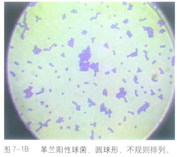 弧菌显微镜下形态与TCBS培养特征图