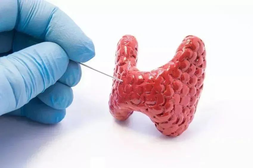 医院诊室内一位医生手持甲状腺模型，向一名女性患者讲解饮食注意事项，桌上放着一份标注“高碘食物禁用”的饮食指南，旁边配有一小碟海带样品并打上红色叉号