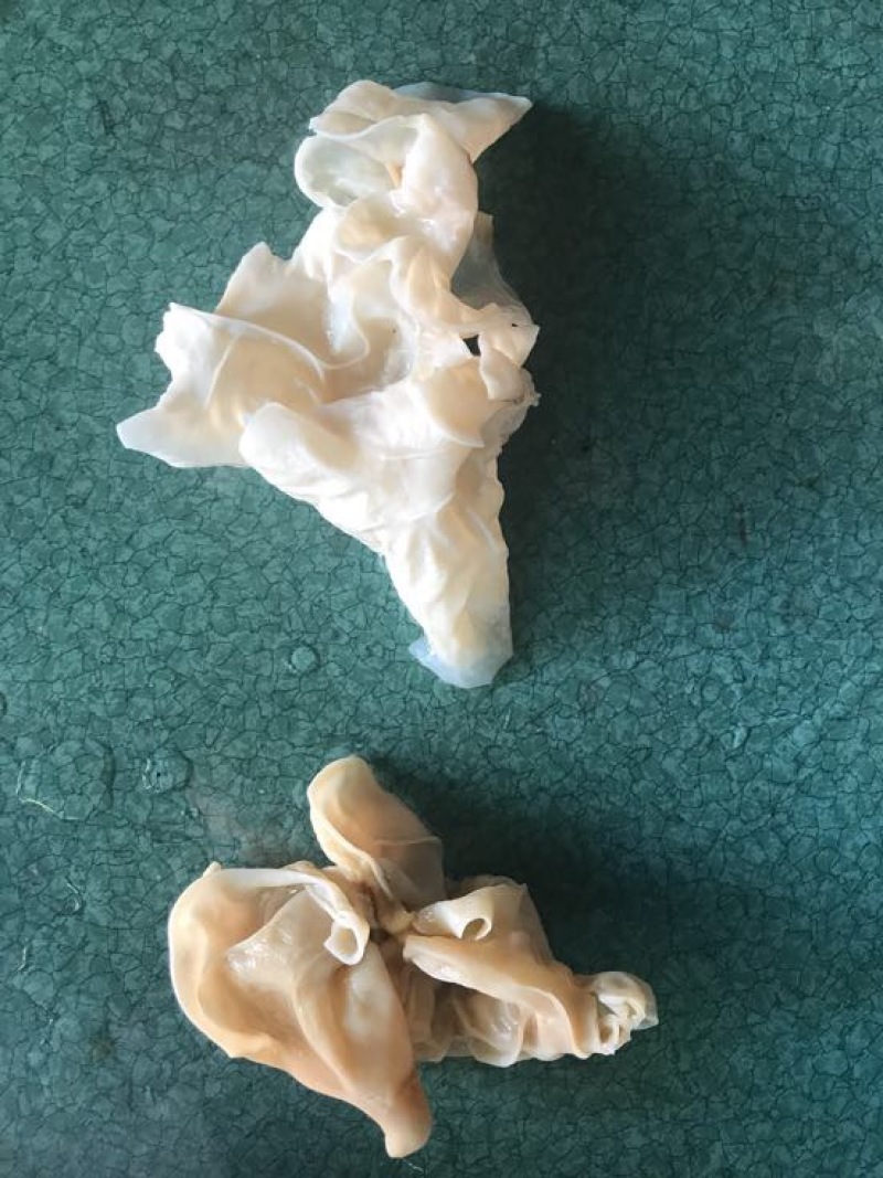 玉木耳特级