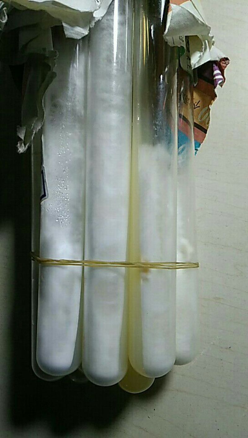 黑皮鸡枞
