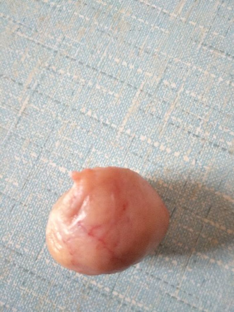 鸡宝