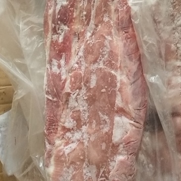 脊骨