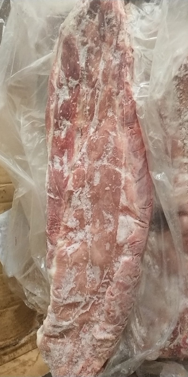 脊骨