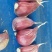 紫皮蒜