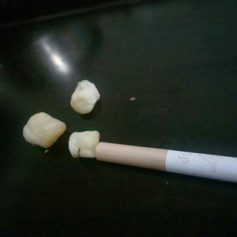 干贝