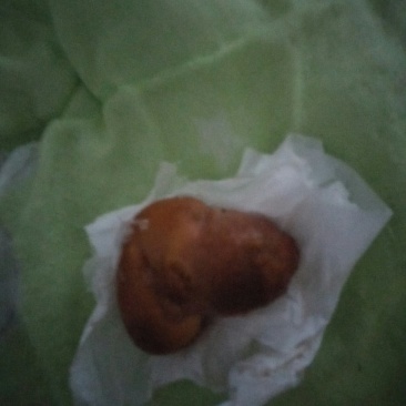 鸡宝