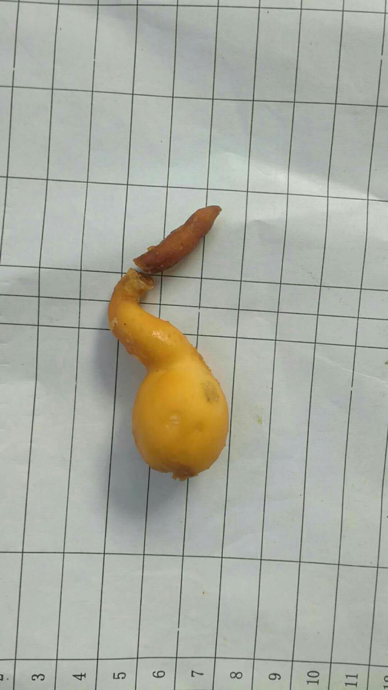 鸭宝