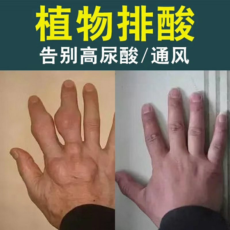 菊苣根茶