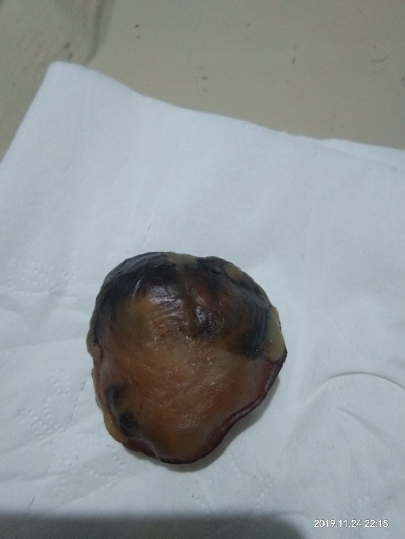鸡宝