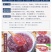 【无杂质】桃胶野生特级食用组合纯正桃花泪