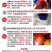精品杨梅（产地代办）一件代发邀实力批发商电商