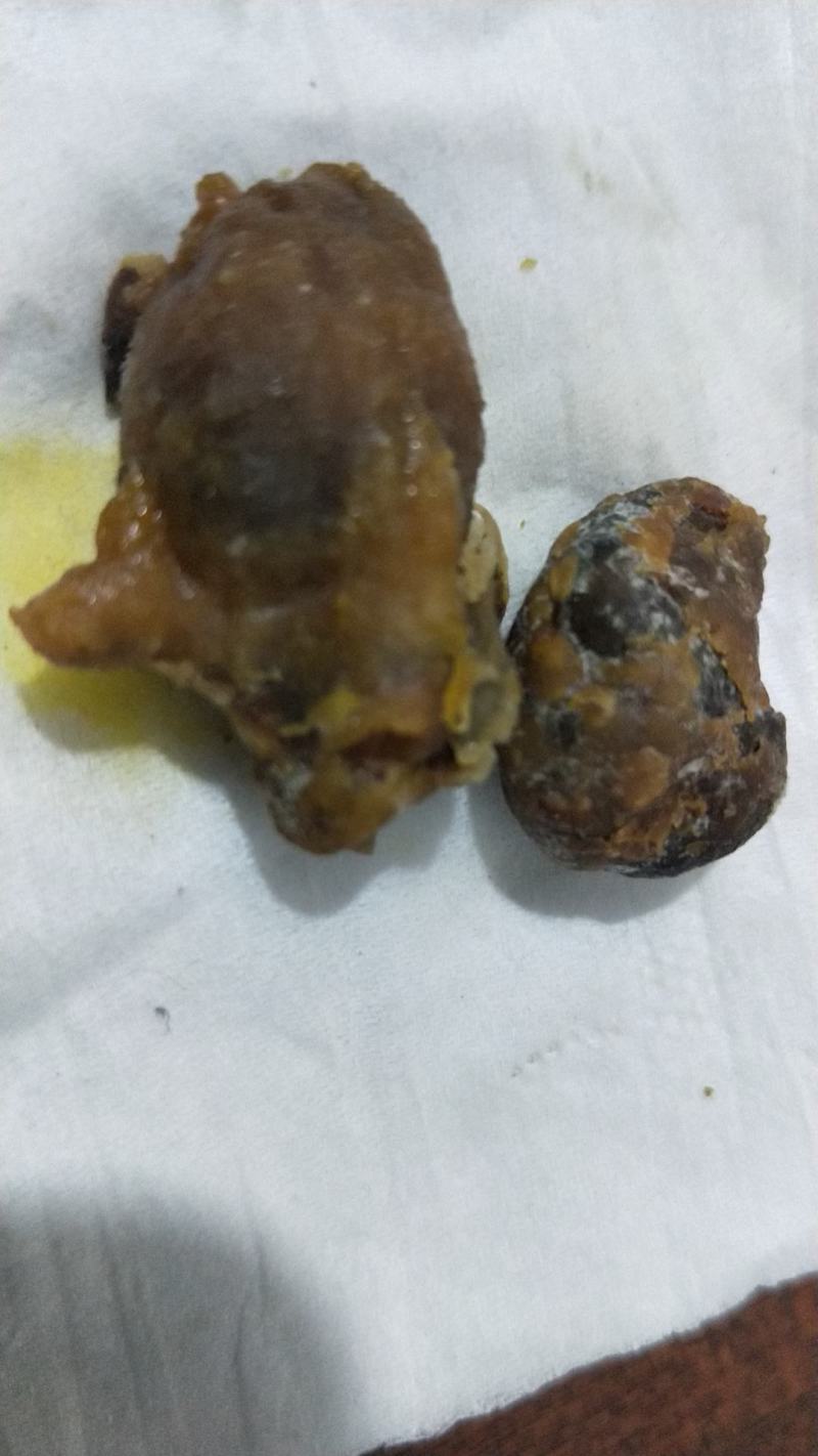 万里挑一的宝中之宝鸡宝