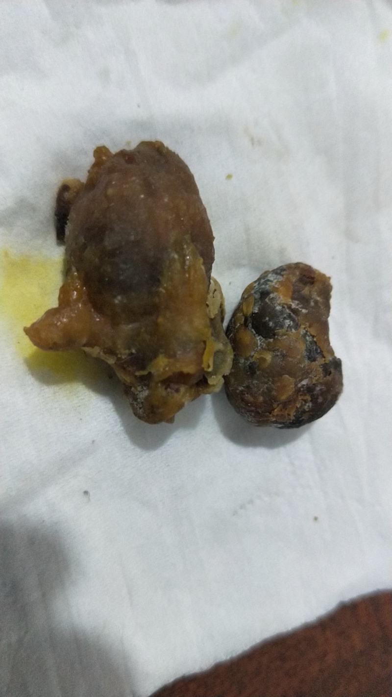 万里挑一的宝中之宝鸡宝