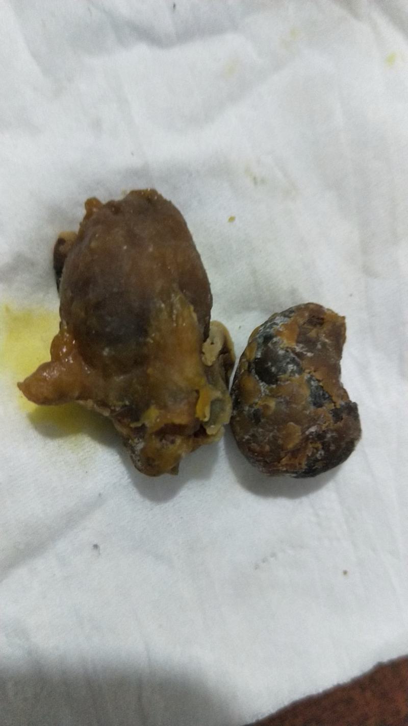 万里挑一的宝中之宝鸡宝