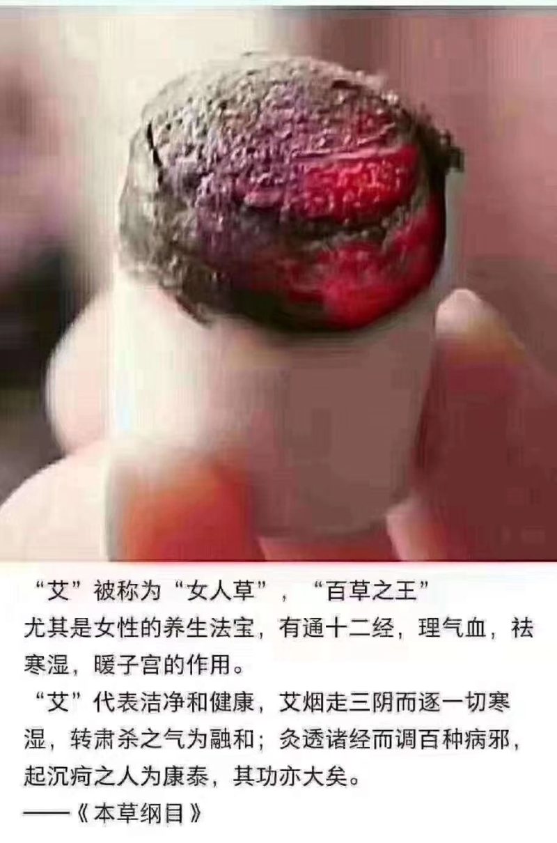 包邮7Cm石磨雷火灸自产自销欢迎定购量大从优