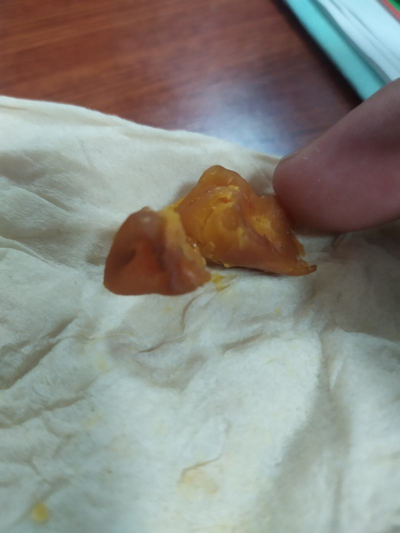 家中杀的老母鸡肚中所得，鸡宝