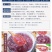 【无杂质】桃胶500g野生天然特级食用组合养颜羹正宗桃胶