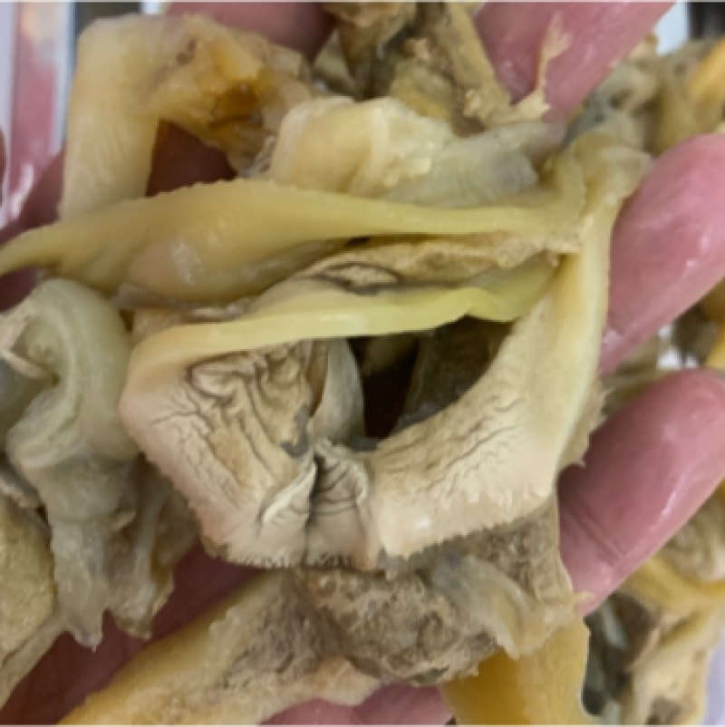 河蚌肉，歪子肉
