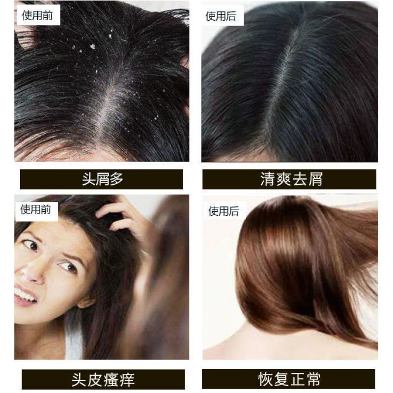 老姜王生姜洗发水去屑止痒控油柔顺洗发膏洗发乳套装男女