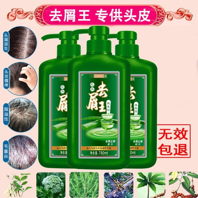 【去屑王】洗发水去屑止痒除螨虫头皮藓洗头膏皮屑神器控油去